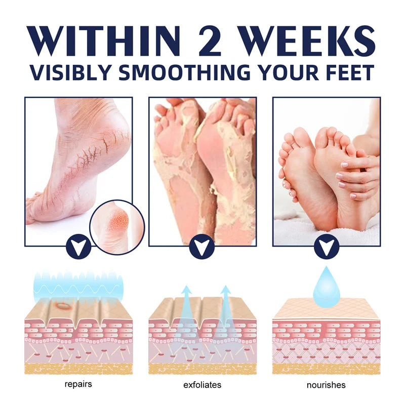 Anti Crack Hand Foot Cream Anti-Drying Heel Cracked Repair Feet Mask Moisturizing Whitening Remover Dead Skin Feet Care Products