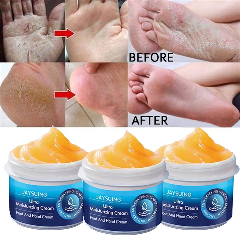 Anti Crack Hand Foot Cream Anti-Drying Heel Cracked Repair Feet Mask Moisturizing Whitening Remover Dead Skin Feet Care Products